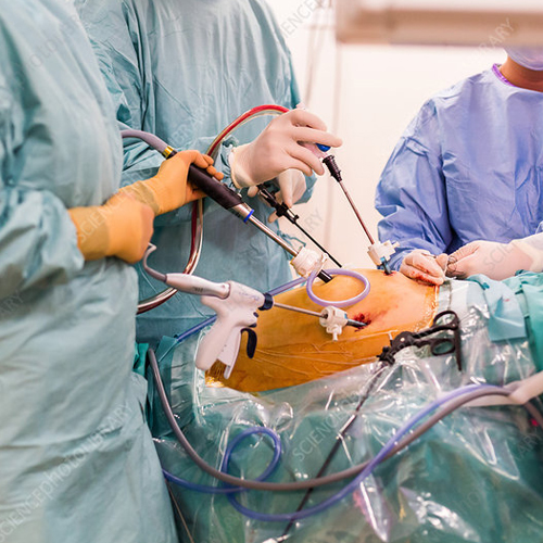 Gynaec Laparoscopic Surgeries